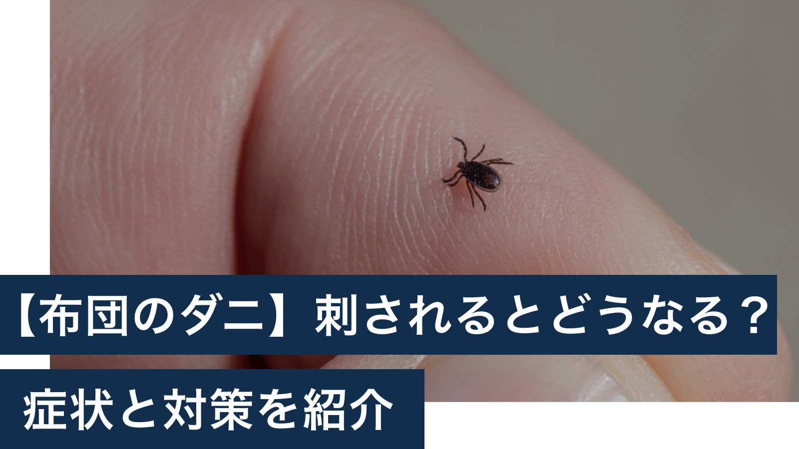 イエダニ対トコジラミ